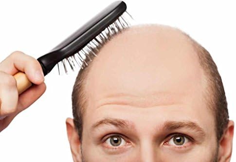 Saç Büyüme Takviyesi dht Engelleyici - DHT Engelleyici Saç Formülü - Erkekler ve Kadınlar için-Saw Palmetto Toplu Takviyeler-3