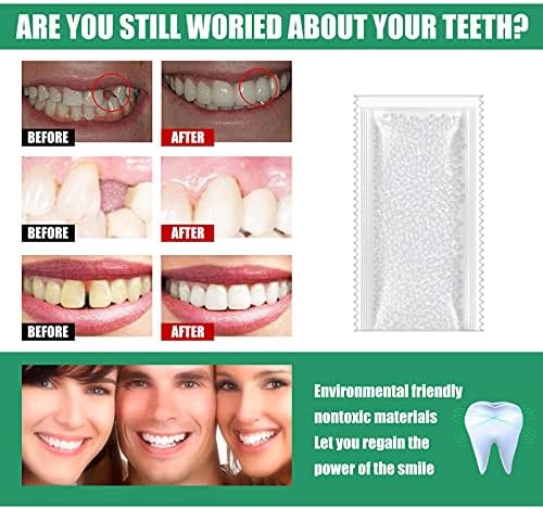 Diş Katı Tutkal Geçici Diş Tamir Kiti Dişler ve Boşluklar Takma Dişler Katı Tutkal Protez Yapıştırıcısı-Sizi Güzelleştirin-Güvenle